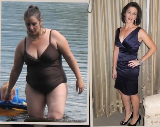 resurge diet pills image